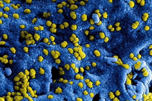 blauwe met gele puntjes staat voor het Coronavirus