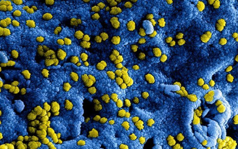blauwe met gele puntjes staat voor het Coronavirus